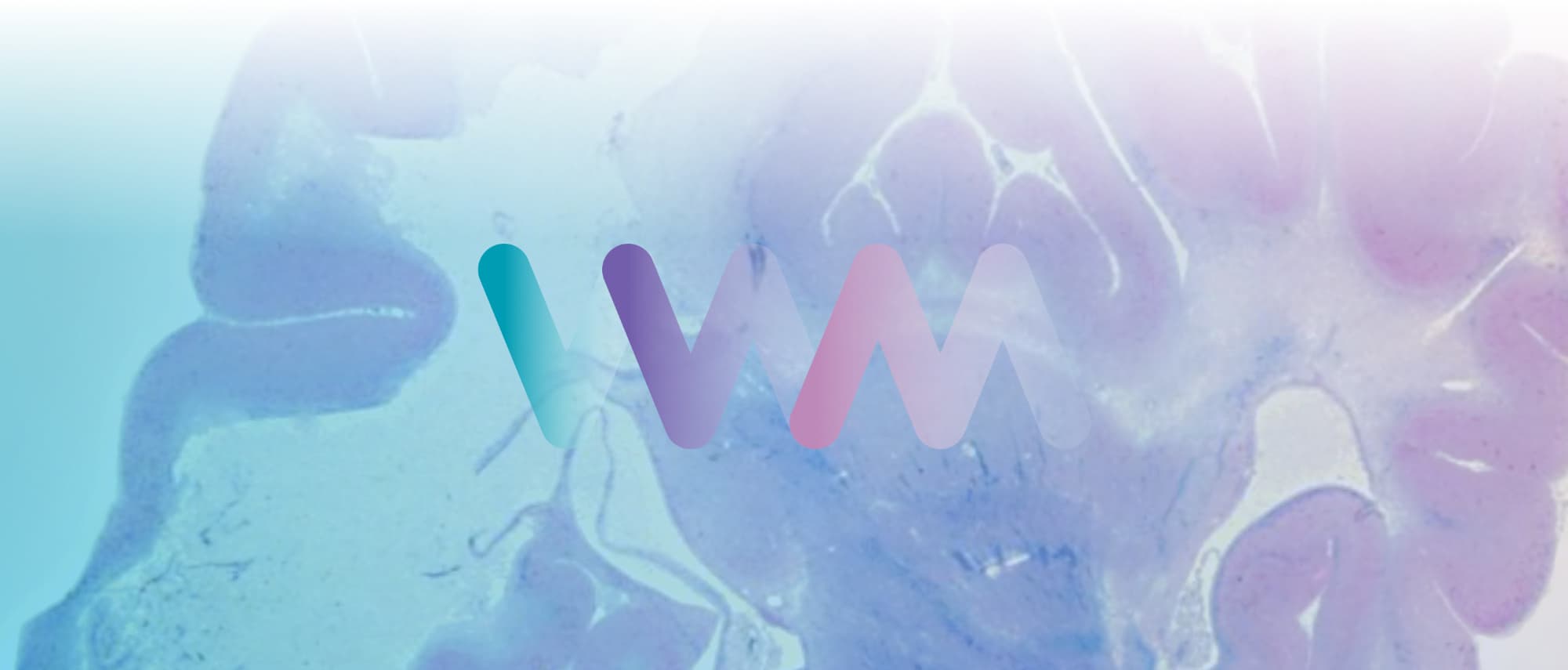 Vanishing White Matter Consortium banner - Rene Verkaart)